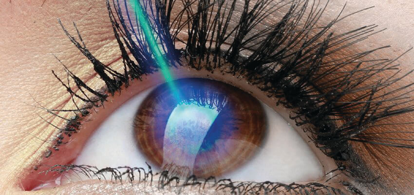 olhos-cirurgia..miopia